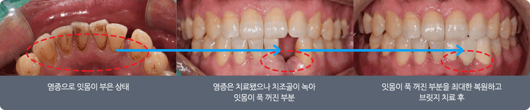 변치 않는 가치