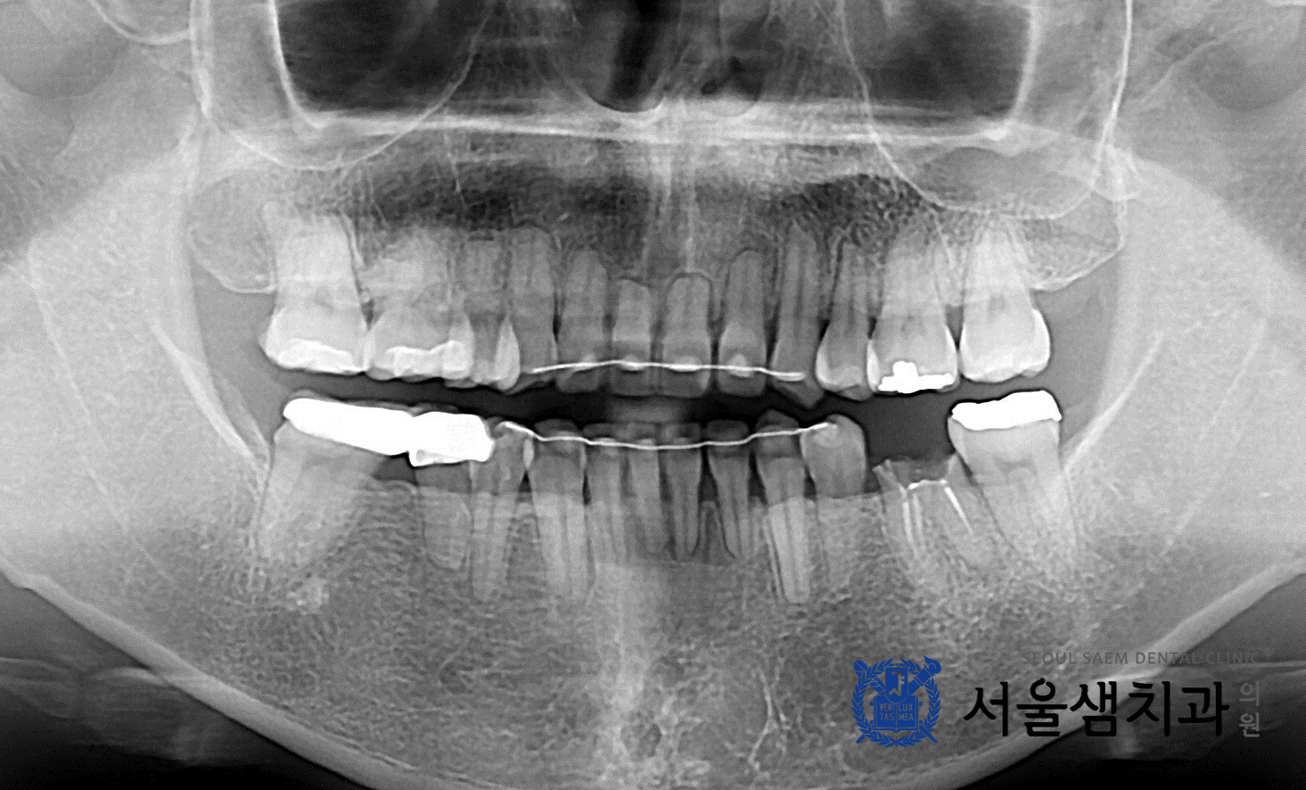 치료사례