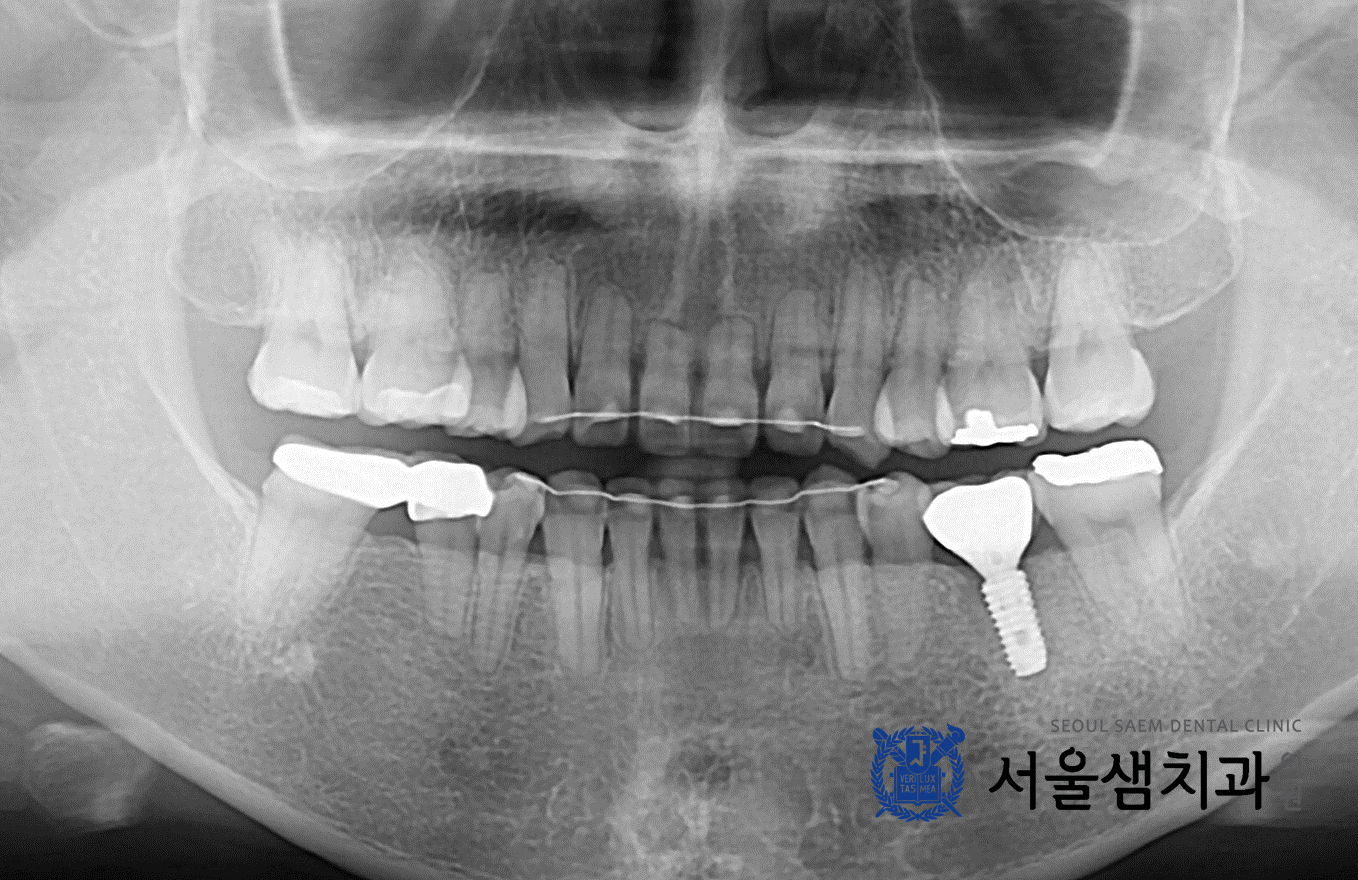 치료사례